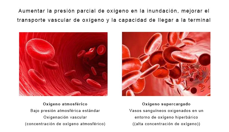 ¿Qué es la oxigenoterapia hiperbárica?